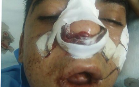 Müəllim şagirdini döyüb ölümcül hala saldı - Azərbaycanda şok hadisə